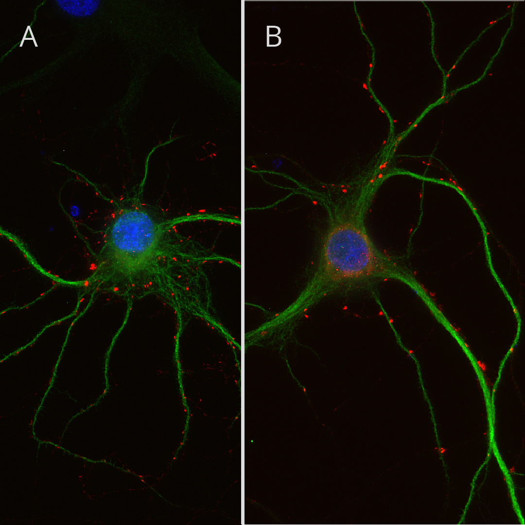 Pre-synaptic localization of VGLUT1 and VGLUT2