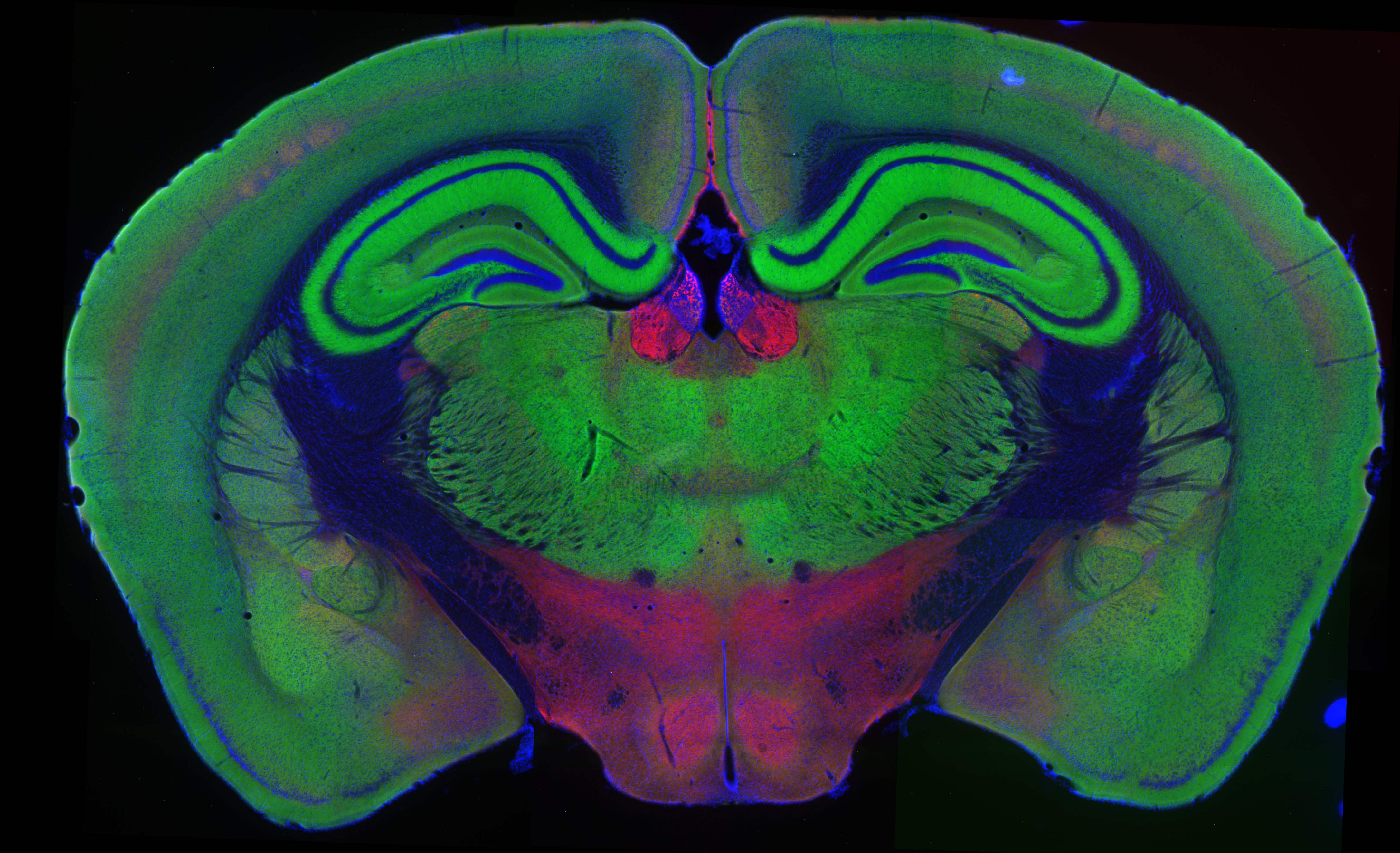 Localization of VGLUT1 and VGLUT in the mouse brain