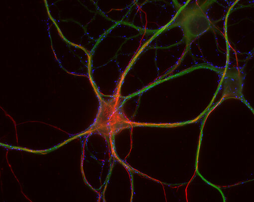 Indirect immunostaining of PFA fixed rat hippocampus neurons with rabbit anti-Neurofilament H