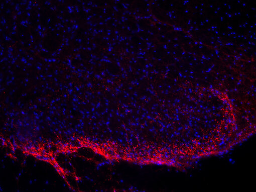 Indirect immunostaining of PFA fixed rat spinal cord section with guinea pig anti-Substance P antibody