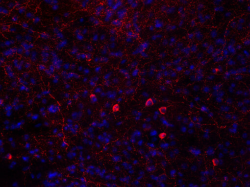 Indirect immunostaining of PFA fixed mouse striatum section with chicken anti-Neuropeptide Y antibody