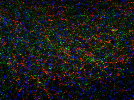 Indirect immunostaining of PFA fixed rat hypothalamus section with guinea pig anti-ACTH antibody