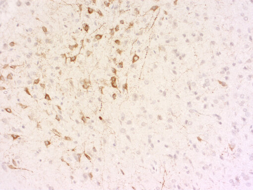 Indirect immunostaining of PFA fixed paraffin embedded rat hypothalamus section with guinea pig anti-Somatostatin-28 antibody
